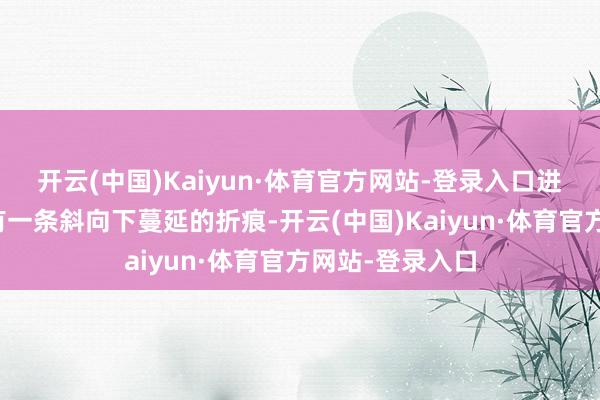 开云(中国)Kaiyun·体育官方网站-登录入口进展为耳垂中部有一条斜向下蔓延的折痕-开云(中国)Kaiyun·体育官方网站-登录入口
